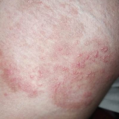 WhatsApp Image 2025-07-06 at 4.43.50 PM (1)