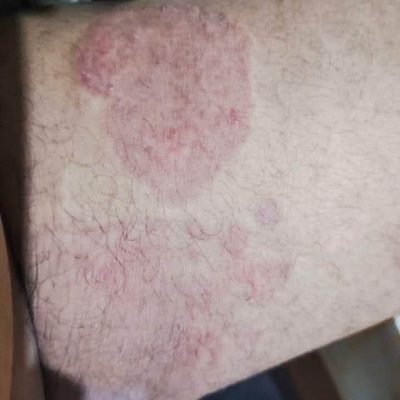 WhatsApp Image 2025-07-06 at 4.43.51 PM